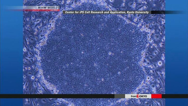 Japanese experts: Intervertebral disk function restored by iPS cells