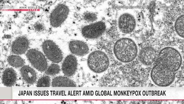 Japan issues level-one alert amid global monkeypox outbreak