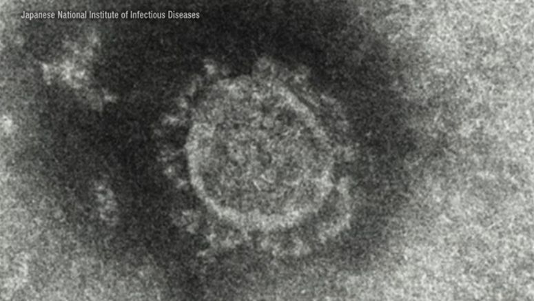 Severe coronavirus cases result in severe cognitive problems